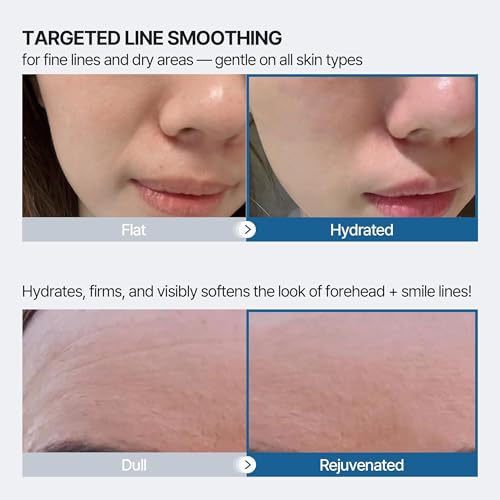 honeydew labs forehead wrinkle patches and smile line patches with retinol collagen peptides- anti wrinkle patches - face tape overnight wrinkle treament for woman for smoothing and firming 36pcs