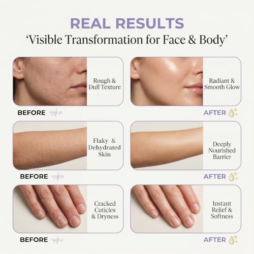 Image of Beef Tallow for Skin - 2Pcs Beef Tallow for Face Cream, Grass-Fed Tallow and Raw Honey Balm with Lavender Essential Oil, Whipped Natural Tallow Face Moisturizer Makeup Cleansing Milk for Dry Home&Away