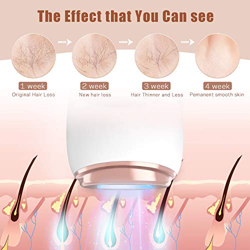 IPL Hair Removal for Women and Men Laser Hair Remover Device for Facial Whole Body, Permanent Painless Upgraded to 999,999 Flashes - Thumbnail 3