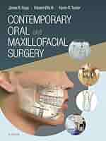 健康・医学 ContemporaryOralandMaxillofacialSurgery Contemporary Oral and Maxillofacial Surgery: 9780323018876