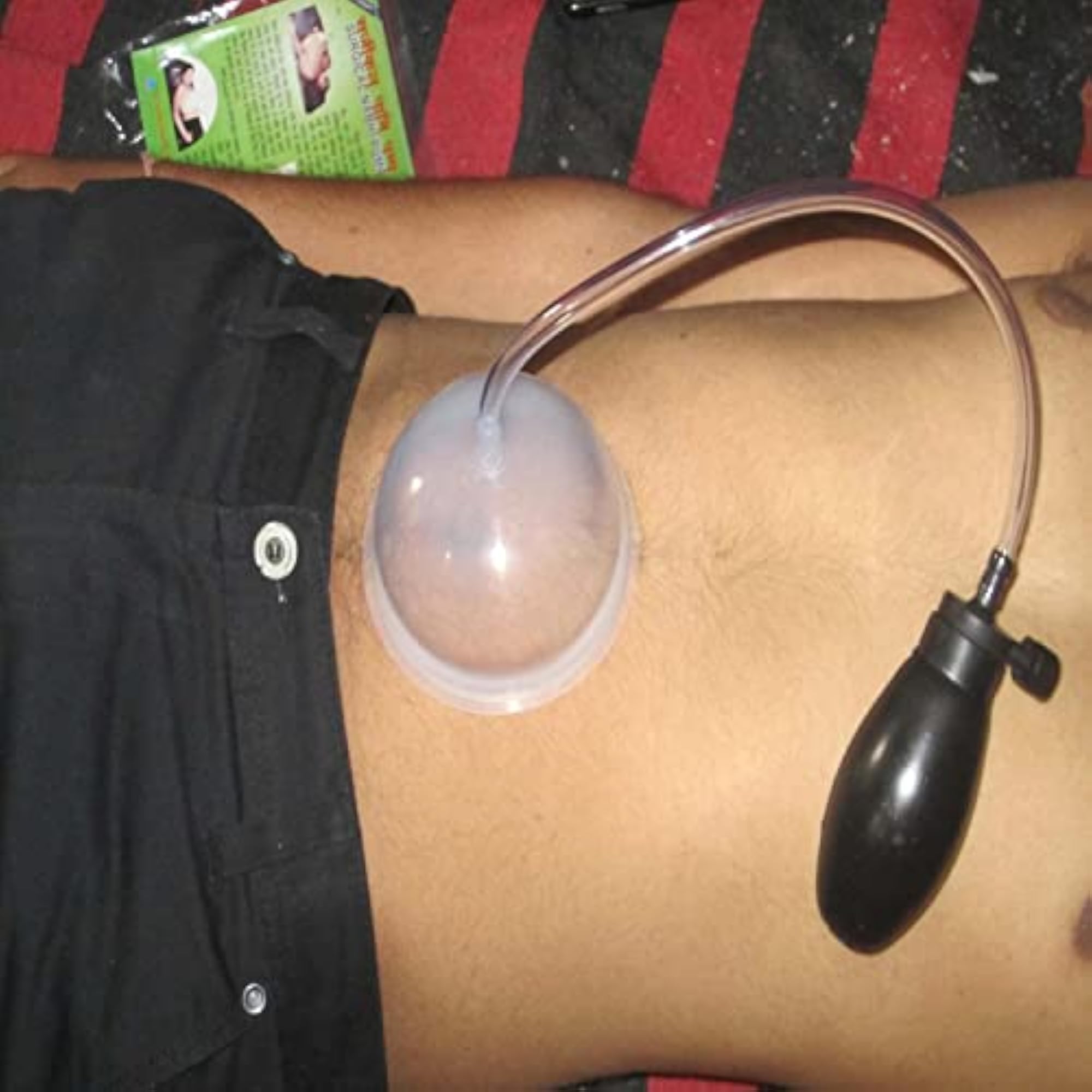 Acupressure Nabhi Pump Surgical Navel imbalance Solar plexus With Bulb Pump