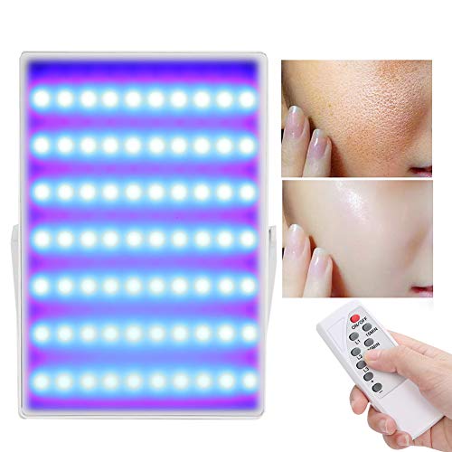 Máquina de remoção de acne, máquina de rejuvenescimento da pele de fótons, função de temporização co