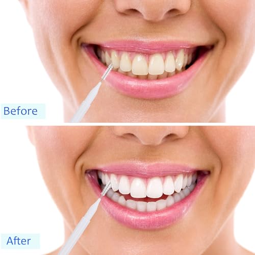 Image of Patelai 100 Pcs Braces Dental Brushes,Black, White, Gray,Mixed Size