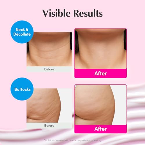 EQQUALBERRY NAD+ Peptide Boosting Cream – NAD+ 5% & 13 Peptides Anti-Aging Korean Skincare Face & Body Cream | Firming & Lifting Pink Neck Cream for Sagging Skin (1.69 fl.oz / 50ml) - Image 4