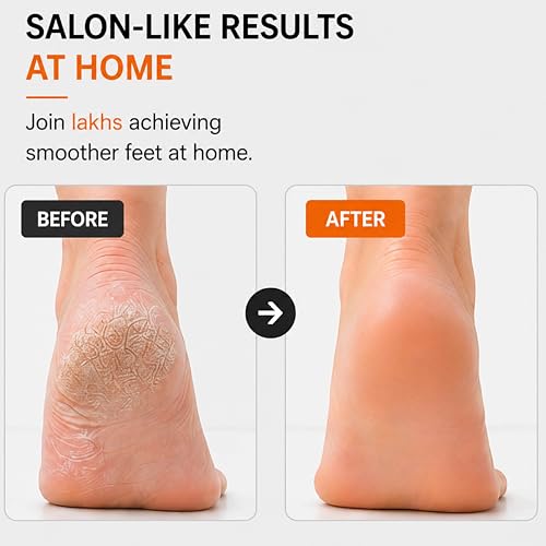 Image of Beaute Secrets Double-Sided Pumice Stone with Handle | Foot Scrubber & Callus Remover for Dead Skin | Pedicure Foot File for Cracked Heels, Corns & Hard Skin - Shower Safe Foot Care Tool