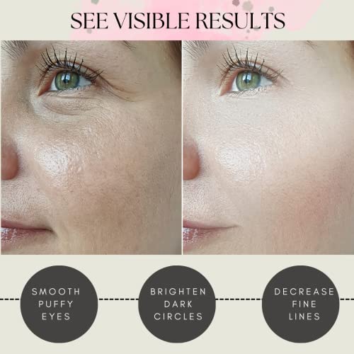 Lookix 24K Gold Collagen Under Eye Patches #TOP25