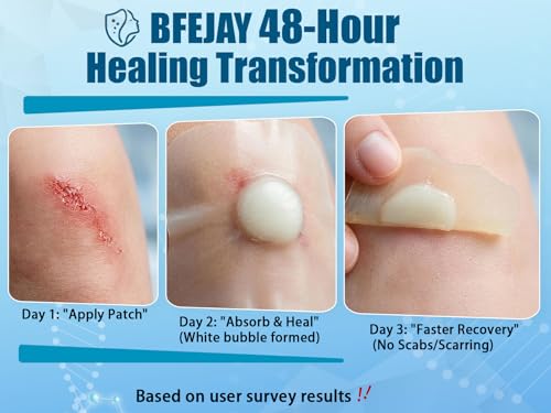 Image of Hydrocolloid Bandages for Wound Care, Medical-Grade Hydrocolloid Roll with Self-Adhesive, Ultra Absorbent, Flexible & Waterproof, Cut-to-Size First Aid Kit Essential (2in*12ft)
