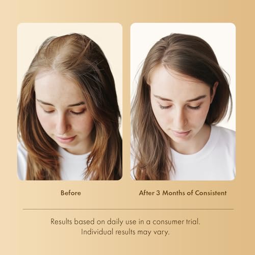 Image of Hair Growth Serum Scalp Treatment: Scalp Serum with Rosemary, Multi-Peptide & Caffeine for Anti Hair Loss and Thinning - Thickening and Density for Women & Men
