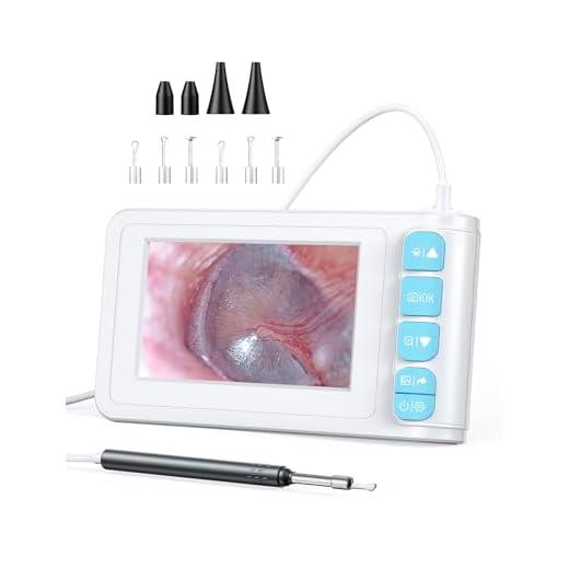 Digital Otoscope with 4.3-inch Screen, SKYEAR Ear Wax Removal Tool Camera with Lights, Long-Lasting for 5 Hours Working Time, Built-in 32GB Card, Photo and Video Capture Capable - White