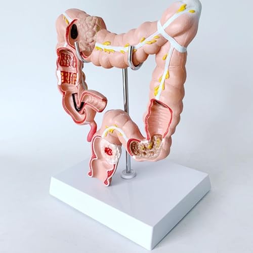 Human Colon Anatomy Model, 3D Human Anatomy Model, Human Anatomy and Physiology Education Replica