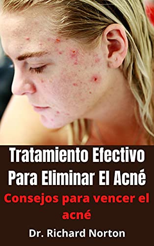 Tratamiento Efectivo Para Eliminar El Acné: Consejos para vencer el acné