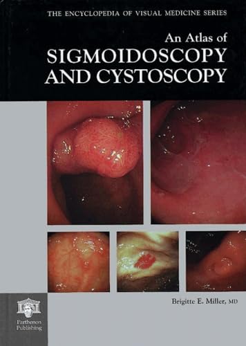 How do you say cystoscopy