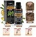 Hair Growth Serum, Hair Treatment, Hair Serum, Hair Loss Treatment, Natural Hair Growth - Anti Hair Loss Promotes Hair Growth, Solution for Hair Thinning and Loss, Hair Regrowth For Men Women