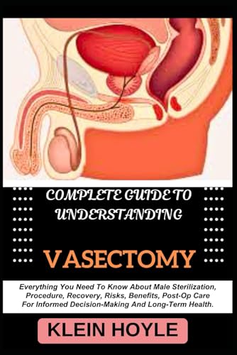 How to book a vasectomy nhs How to book a vasectomy nhs