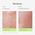 MAREE Exfoliating Toner with Salicylic Acid – AHA BHA Face Exfoliant & Pore Cleaner – BHA Liquid Exfoliant for Sebum & Dead Skin Care Remover – Face Exfoliator – Acido Salicilico Exfoliante Facial - Image 5