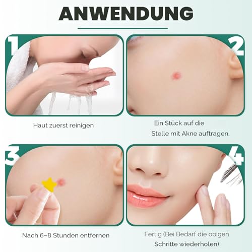 397 Stück Pimple Patch Hydrokolloid Pflaster Pickel Patch Unsichtbare NatüRliche Mit SalicylsäUre Und TeebaumöL Tag Und Nacht 2-In-1 Anti Pickel Patches Acne Wasserdicht Atmungsaktiv Absorptions