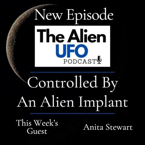 Controlled by an Alien Implant