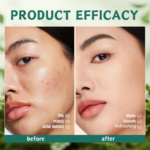 Salicylic Acid Acne Treatment for Face Skincare Set - 4 Pcs Christmas Gifts for Women - Skin Care for Teens 10-12 - Acne Kit with Cleanser,Serum,Cream,Essence Water - Acne Sp-ot Treatment
