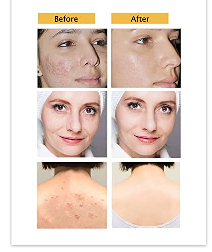 Wsiruyi Turmeric Botanical Bath Soap Bar,100G Handmade Ginger Essential Oils Soap Gift For Men & Women,Natural Ingredients,Face Body Moisturizing Artisanal Soap With Blistering Net #TOP5