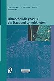 Ultraschalldiagnostik der Haut und Lymphknoten