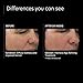 PCA SKIN Intensive Anti Aging Retinol Serum, 0.5% Pure Retinol Face Serum, Minimizes Fine Lines and Wrinkles, 1 fl oz Tube