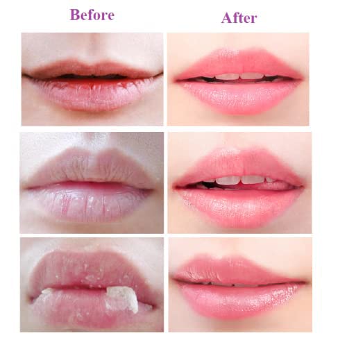 Krajiyya 2Pcs Lip Balm Honey Pot,Propolis Moisturizing Honey Lip Mask Lip Balm,Hydrating & Prevention Dry And Cracked Lip Scrubs Exfoliator thumb #5
