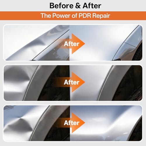 Image of Paintless Dent Repair Kit for Car, PDR Dent Removal Tools with Dent Lifter & Pro Dent Puller Tabs, Auto Body Dent Puller for Car Dent Repair, Hail Damage Repair