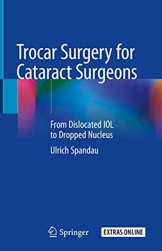 Trocar Surgery for Cataract Surgeons: From Dislocated IOL to Dropped Nucleus (English Edition)