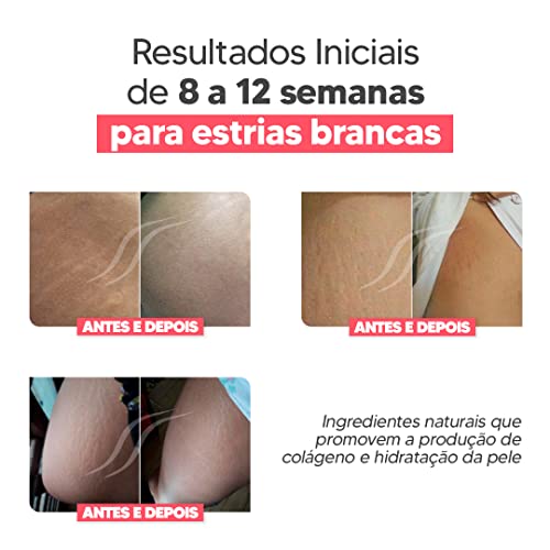 Creme Para Estrias Cicatrissim White - Kit 2unidades - Redutor de Estrias Brancas e Antigas