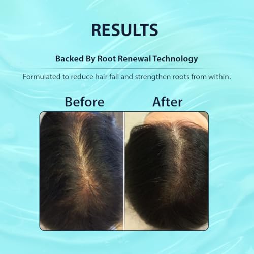 Image of Dermistry Follicusan Hairgenyl & Caffeine Hair Fall Control Hair Serum Strengthens Roots Improves Hair Thickness Density & Reduces Breakagses for Dry Frizzy Curly All Hair Type Men Women 50ml