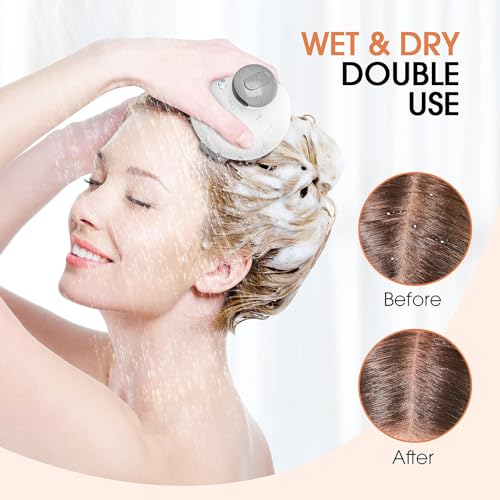 Eazy2hD Electric Scalp Massager with 5 Removable Massage Claws Hair Growth Portable Rechargeable Head Massager Scalp with Kneading 95 Massage Nodes Stress Relax Gifts for Friend