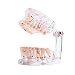 Easyinsmile Dental Pathology Model Half Implant Tooth Model for Dentist Studying Researching and Patient Education