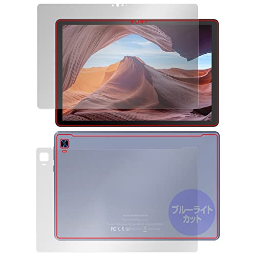 ~rbNX VANKYO MatrixPad S31X p u[CgJbg  ڂɗD ی tB tEw Zbg { OverLay Eye Protector