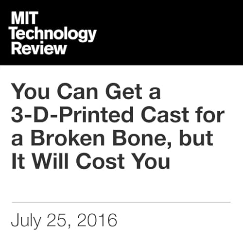 You Can Get a 3-D-Printed Cast for a Broken Bone, but It Will Cost You