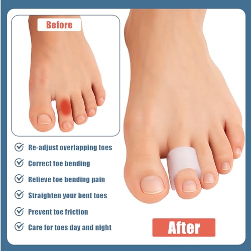Image of 12 Pack Hammer Toe Straightener Corrector, Bunion Corrector Toe Separators for Women and Men, Toe Spacers for Bunion, Overlapping Toes, Curled Toes,Hammertoes Toe Corrector (3Size)