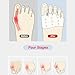 Silicone Toe Separators, Briza Toe Sleeves, Hallux Valgus Relief - Toe Straightener & Spacer for Women & Men, Breathable Soft and Comfortable Gel Foot Cushions (Transparent)