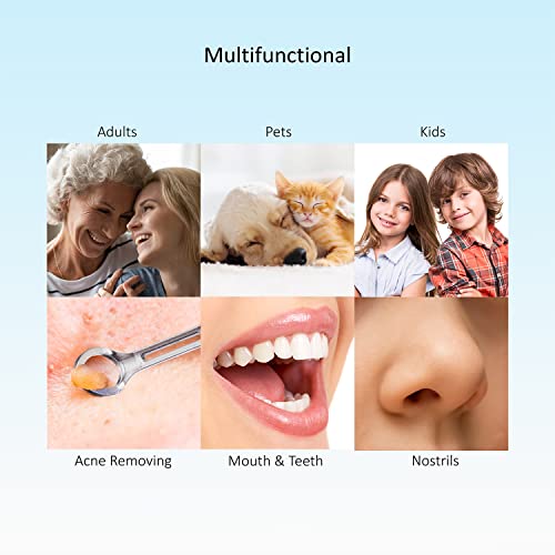 Physician-Tested Ear Wax Removal, 27-Piece Visual Ear Cleaning Kit, Ear Wax Removal Tool Camera, Ear Camera Otoscope With Light For Ios & Android (White) #TOP5