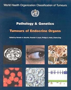 Pathology And Genetics of Tumors of Endocrine Organs (World Health Organization Classification of Tumours)