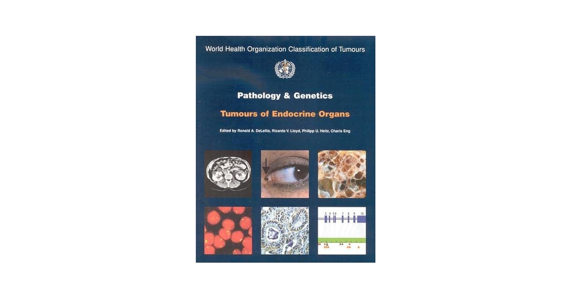 語学+参考書 Pathology And Genetics of Tumors of Endocrine Organs (World Health Organization Classification of Tumours) Amazon | Pathology And Genetics of Tumors of Endocrine