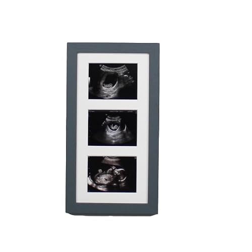Baby Scan Photo Frame, Multi-Aperture Frame for Three Ultrasound Photos. Baby Shower | Pregnancy Announcement | Nursery Display (Dark Grey)