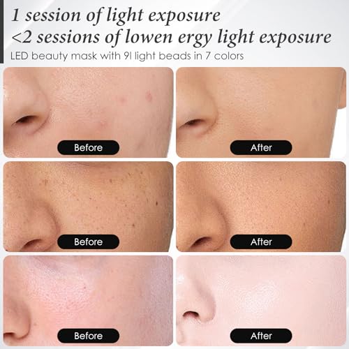 Sdkwdh A-021 7-1 Colors Led Facial Skin Care Mask, Red Led Face Mask Light Therapy At Home thumb #4
