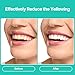 Teeth Whitening Gel Refill, 8 Packs, 35% Carbamide Peroxide Whitening Gel for Trays, Profesional Teeth Bleaching Gel for Fast Result, Work with Teeth Whitening Kit, IMOSTY Whitening Gel (8 x 3ml)