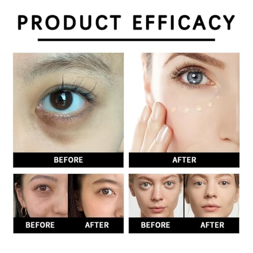 Eye Corrector SPF 41, Eye Concealer For Dark Circles, Under Eye Corrector Cream, Moisturizing Eye Essence Cream for All Skin Type (01# Natural) - Image 6