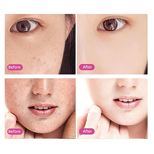 Concepta Therapy MyM Derma Pen with 2 Extra 12 Needles Cartridges Derma Pen | Mesopen for Anti Aging | Skin Facial Care | Skin Rejuvenation - Image 4