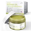 Batana Oil For Hair Growth - 3in1 Hair Serum, 4.2 oz, Batana Oil + Minoxidil + Rosemary, For Thinning Hair & Scalp Care
