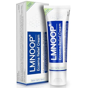 best heat rash ointment