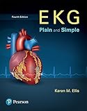 EKG Plain and Simple