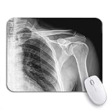 Mattes Finish - fühlt sich weich an