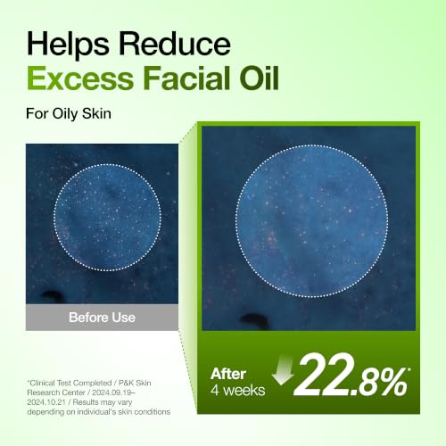 Image of Anua Azelaic Acid 10 Hyaluron Redness Soothing Serum with Cica Soothes & Calms Acne-Prone Skin