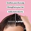 Grow-New-Hair-Treatment-Hair-Regrowth-Oil-Natural-Hair-Care-Hair-Growth-Treatment-For-Men-and-Women-Just-Nutritive-4-Oz Grow New Hair Treatment | Hair Regrowth Oil | Natural Hair Care | Hair Growth Treatment For Men and Women | Just Nutritive | 4 Oz